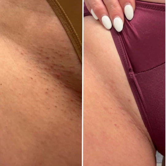 Intimate Lightening Cream