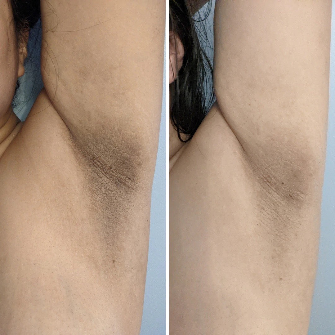 Dear Kitty Intimate Lightening Cream for Underarms