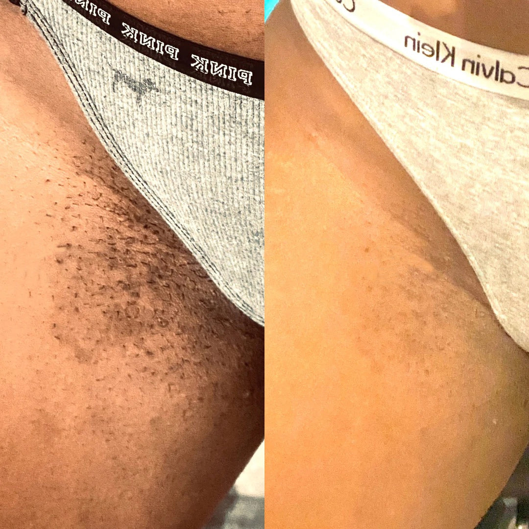 Intimate Lightening Cream