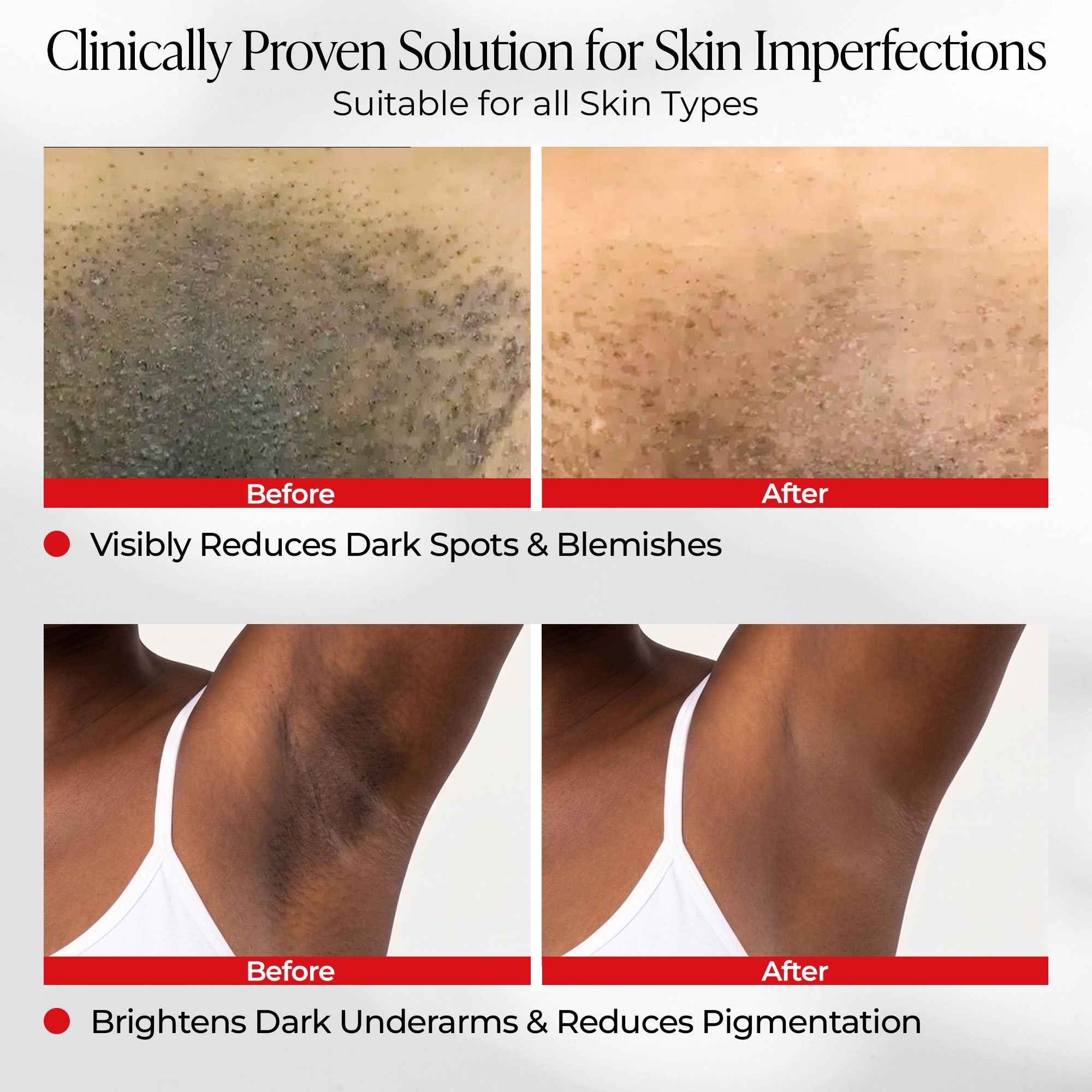 Tranexamic &amp; Niacinamide Advanced Brightening Cream for Hyperpigmentation